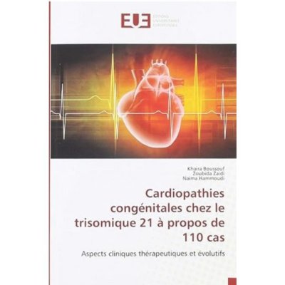 Cardiopathies congénitales chez le trisomique 21 à propos de 110 cas de Khaira Boussouf