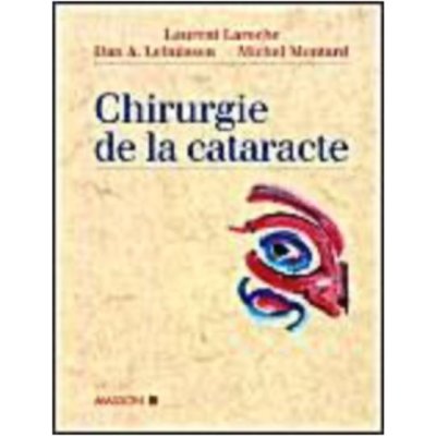 Chirurgie de la cataracte de Laurent Laroche, Dan Alexandre et Michel Montard
