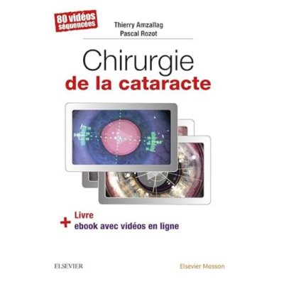 Chirurgie de la cataracte: 60 Videos Sequencees de Docteur Thierry Amzallag et Docteur Pascal Rozot