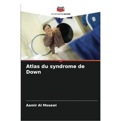 Atlas du syndrome de Down de Aamir Al Mosawi