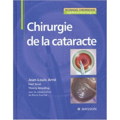 Chirurgie de la cataracte de Jean-Louis Arné